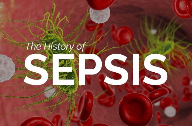 history of sepsis icd10